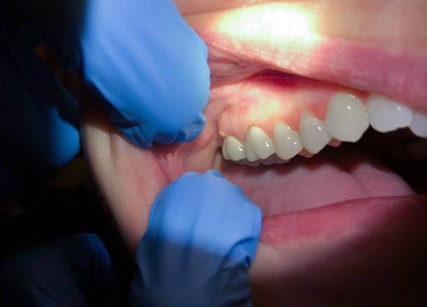 Best Emergency Gum Pain Relief  in Beverly Hills, MI